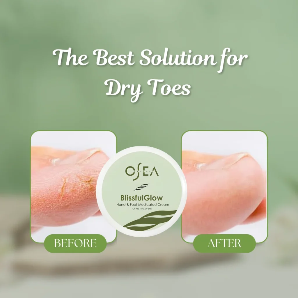 Dry Toes