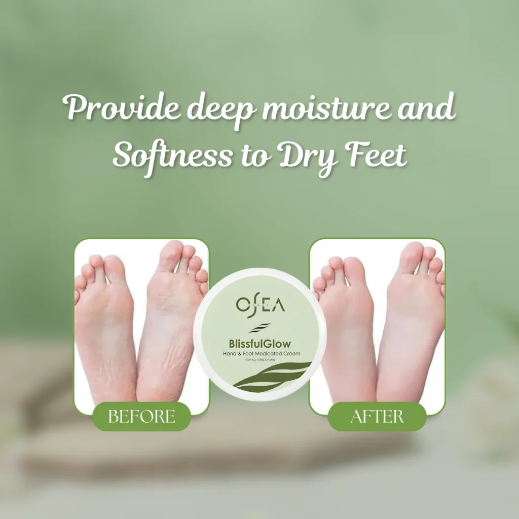 Dry feets